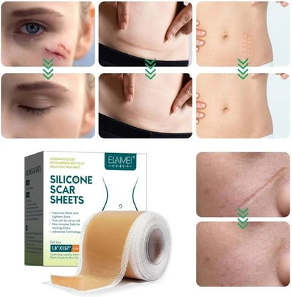 Silicone Scar Remover Tape for Acne & Wrinkles